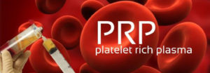 Platelet Rich Plasma Pain treatment